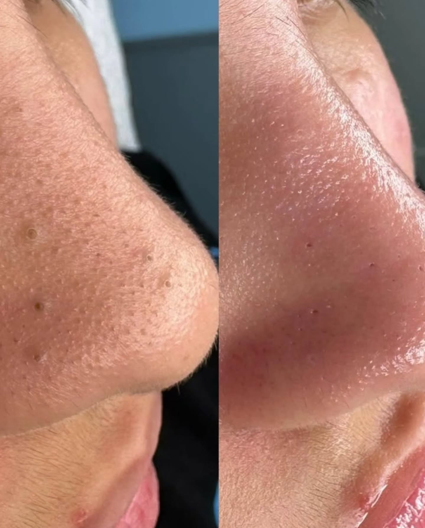 Before and after skin comparison